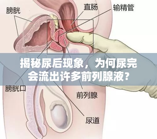 揭秘尿后現(xiàn)象，為何尿完會流出許多前列腺液？