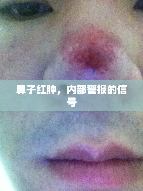 鼻子紅腫，內(nèi)部警報的信號