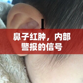 鼻子紅腫，內(nèi)部警報的信號