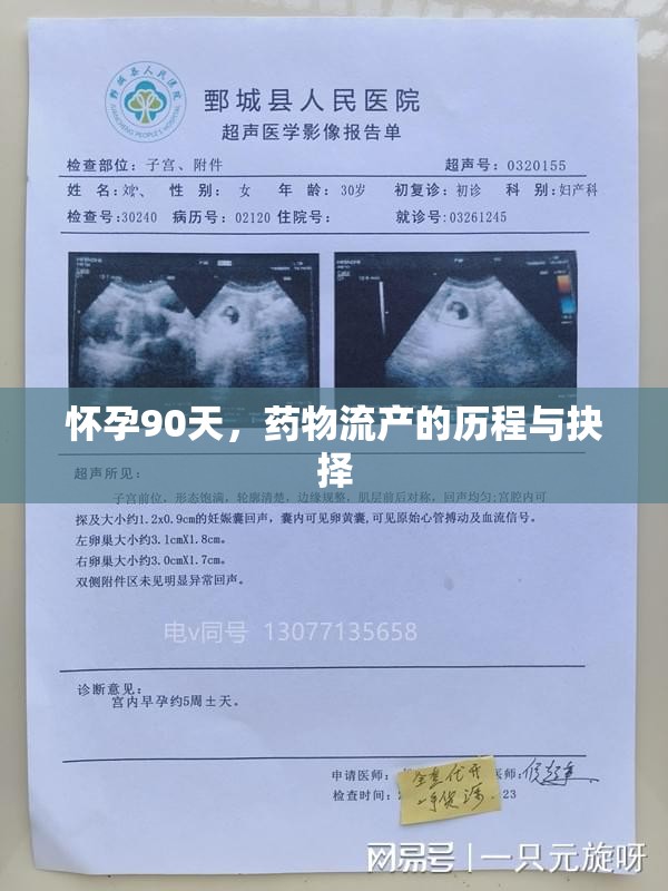 懷孕90天，藥物流產(chǎn)的歷程與抉擇