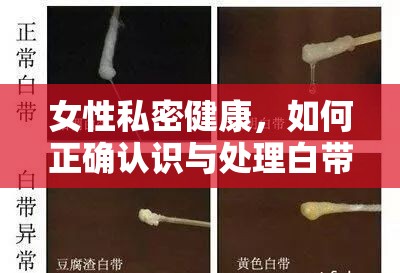 女性私密健康，如何正確認(rèn)識(shí)與處理白帶流出