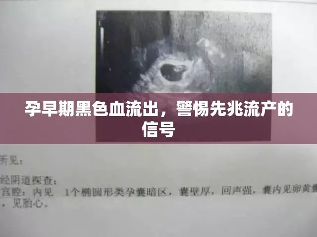 孕早期黑色血流出，警惕先兆流產(chǎn)的信號