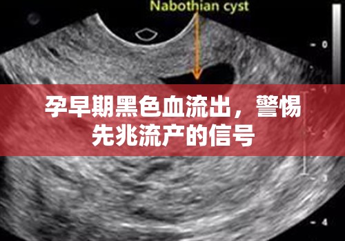 孕早期黑色血流出，警惕先兆流產(chǎn)的信號
