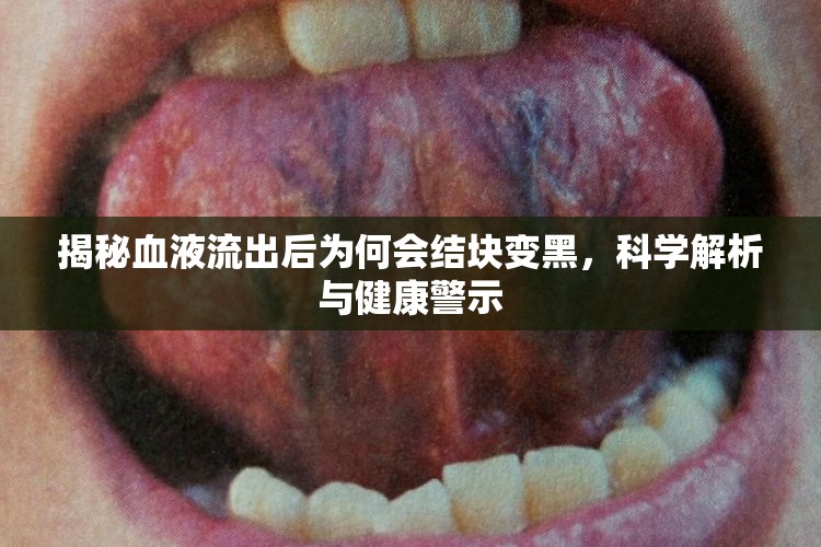 揭秘血液流出后為何會結(jié)塊變黑，科學(xué)解析與健康警示