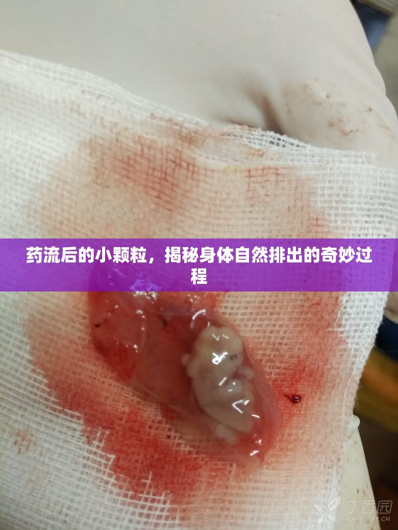 藥流后的小顆粒，揭秘身體自然排出的奇妙過(guò)程