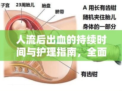 人流后出血的持續(xù)時間與護理指南，全面解析