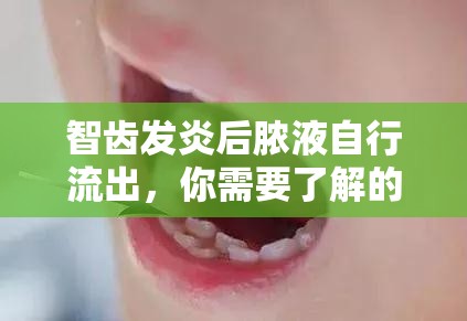 智齒發(fā)炎后膿液自行流出，你需要了解的注意事項