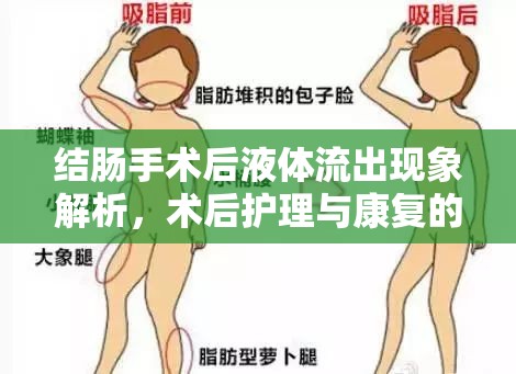 結(jié)腸手術(shù)后液體流出現(xiàn)象解析，術(shù)后護(hù)理與康復(fù)的必備知識(shí)
