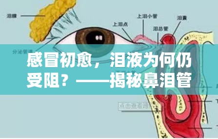 感冒初愈，淚液為何仍受阻？——揭秘鼻淚管與感冒的后遺效應(yīng)
