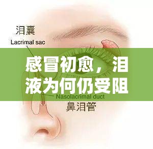 感冒初愈，淚液為何仍受阻？——揭秘鼻淚管與感冒的后遺效應(yīng)