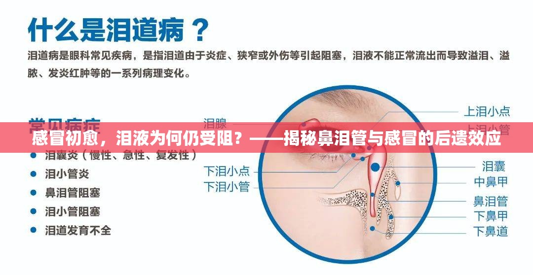 感冒初愈，淚液為何仍受阻？——揭秘鼻淚管與感冒的后遺效應(yīng)