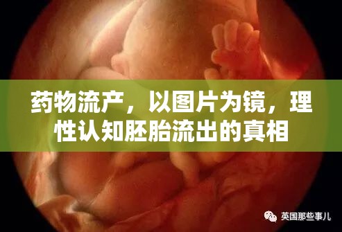 藥物流產(chǎn)，以圖片為鏡，理性認知胚胎流出的真相