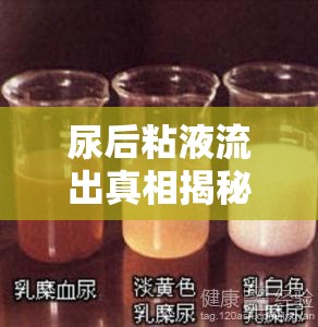 尿后粘液流出真相揭秘，健康警報(bào)與日常護(hù)理指南