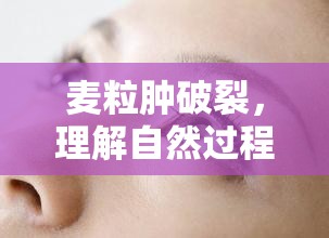 麥粒腫破裂，理解自然過(guò)程與應(yīng)對(duì)策略
