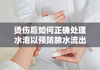 燙傷后如何正確處理水泡以預(yù)防膿水流出