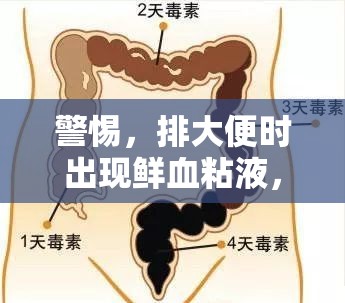 警惕，排大便時出現(xiàn)鮮血粘液，可能是腸道健康的重要信號