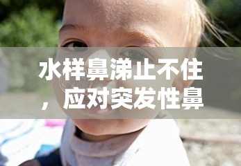 水樣鼻涕止不住，應(yīng)對突發(fā)性鼻漏的實用指南