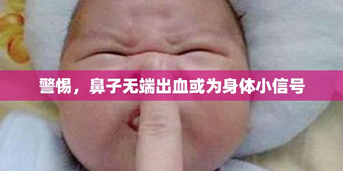 警惕，鼻子無端出血或?yàn)樯眢w小信號(hào)