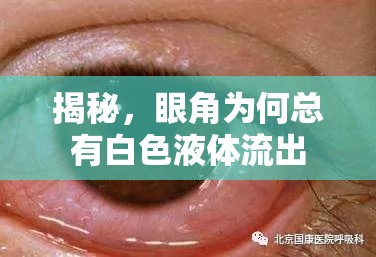 揭秘，眼角為何總有白色液體流出