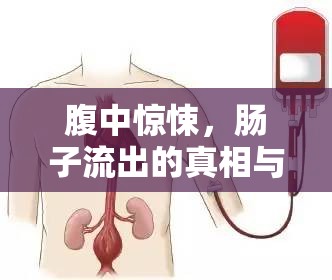 腹中驚悚，腸子流出的真相與應(yīng)對