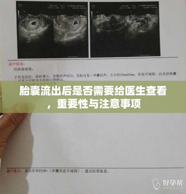 胎囊流出后是否需要給醫(yī)生查看，重要性與注意事項(xiàng)