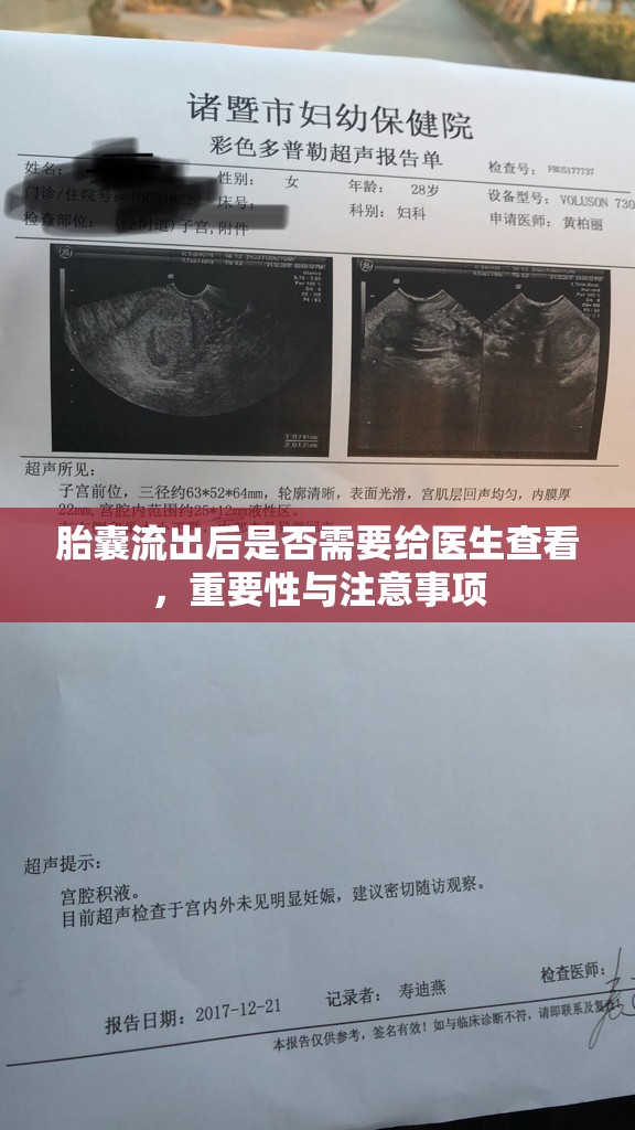胎囊流出后是否需要給醫(yī)生查看，重要性與注意事項(xiàng)