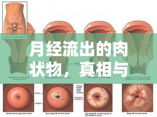 月經(jīng)流出的肉狀物，真相與誤解的深度解析
