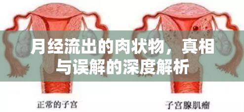 月經(jīng)流出的肉狀物，真相與誤解的深度解析