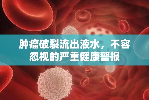 腫瘤破裂流出液水，不容忽視的嚴(yán)重健康警報
