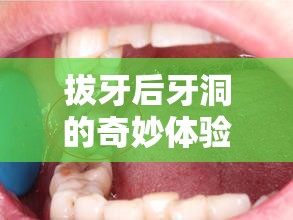 拔牙后牙洞的奇妙體驗，當感覺有東西流出的那一刻