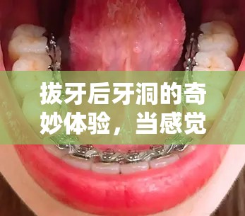 拔牙后牙洞的奇妙體驗，當感覺有東西流出的那一刻
