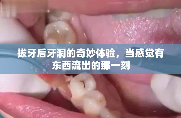 拔牙后牙洞的奇妙體驗，當感覺有東西流出的那一刻