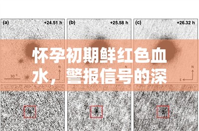 懷孕初期鮮紅色血水，警報信號的深度解析