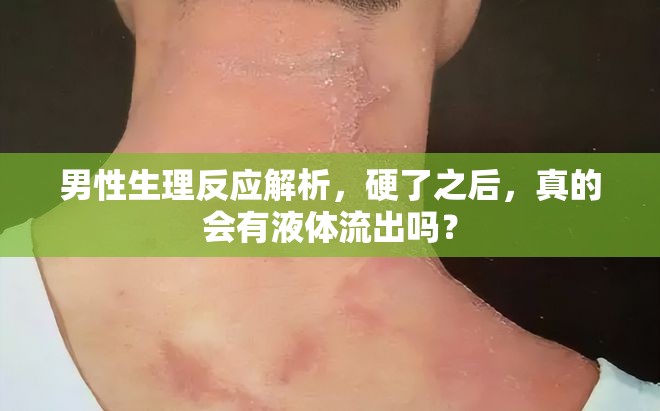 男性生理反應(yīng)解析，硬了之后，真的會有液體流出嗎？