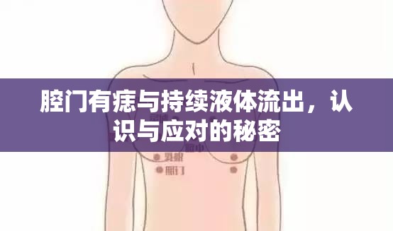 腔門有痣與持續(xù)液體流出，認(rèn)識與應(yīng)對的秘密
