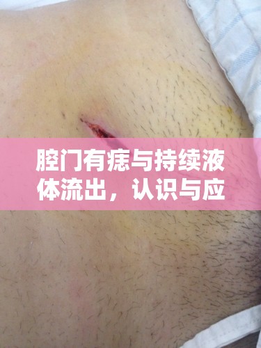 腔門有痣與持續(xù)液體流出，認(rèn)識與應(yīng)對的秘密