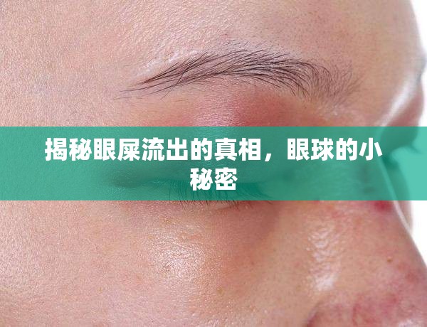 揭秘眼屎流出的真相，眼球的小秘密