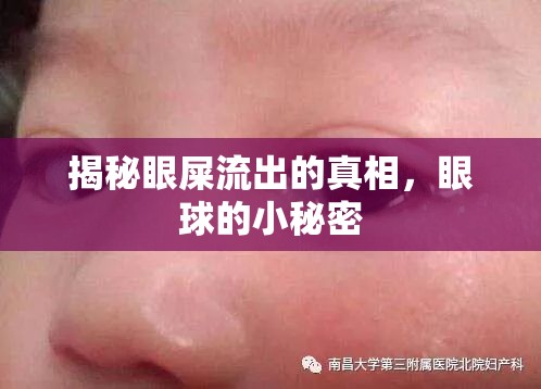 揭秘眼屎流出的真相，眼球的小秘密