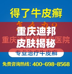重慶迪邦皮膚揭秘，專業(yè)皮膚健康管理的秘密