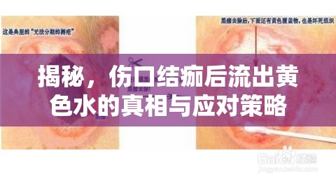 揭秘，傷口結(jié)痂后流出黃色水的真相與應(yīng)對策略