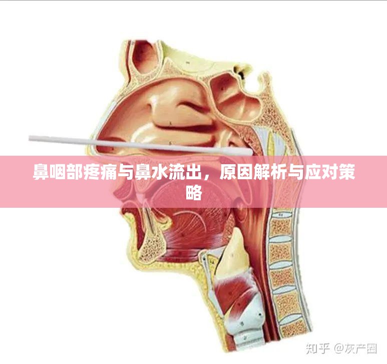 鼻咽部疼痛與鼻水流出，原因解析與應(yīng)對策略