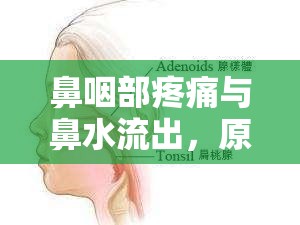 鼻咽部疼痛與鼻水流出，原因解析與應(yīng)對策略
