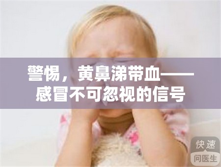 警惕，黃鼻涕帶血——感冒不可忽視的信號(hào)