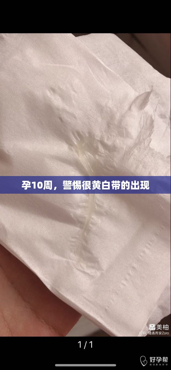 孕10周，警惕很黃白帶的出現(xiàn)