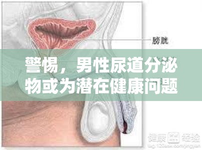 警惕，男性尿道分泌物或為潛在健康問題信號