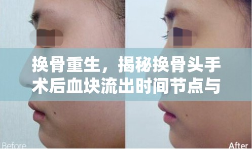 換骨重生，揭秘?fù)Q骨頭手術(shù)后血塊流出時(shí)間節(jié)點(diǎn)與護(hù)理要點(diǎn)
