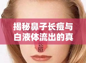 揭秘鼻子長痘與白液體流出的真相