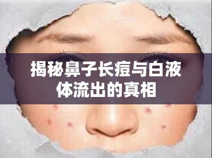 揭秘鼻子長痘與白液體流出的真相