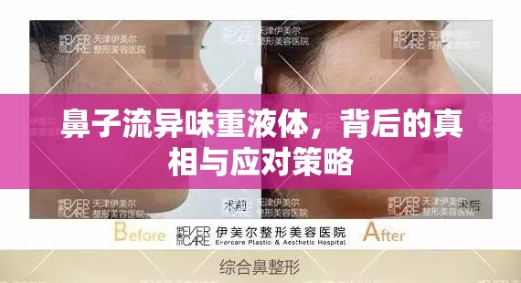 鼻子流異味重液體，背后的真相與應(yīng)對策略