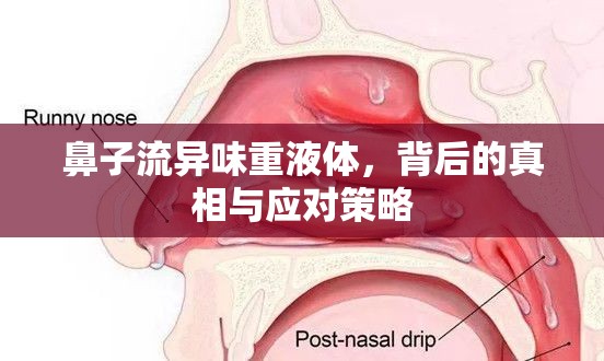鼻子流異味重液體，背后的真相與應(yīng)對策略